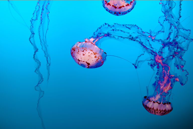 Jellyfish sting